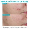 Suero Effaclar Salicylic Acné de La Roche Posay, foto 2